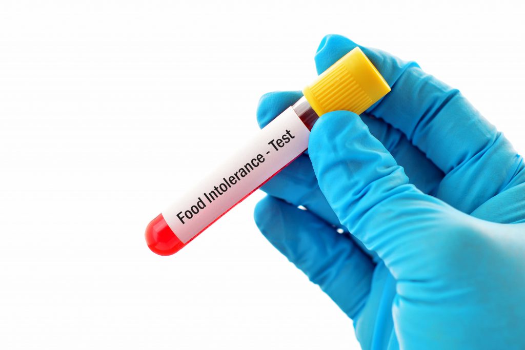 Food allergy and Sensitivity testing 