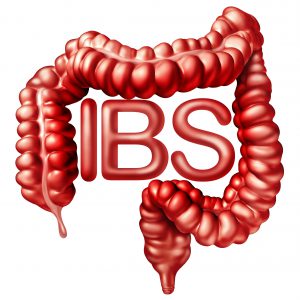 functional-medicine-IBS-specialist