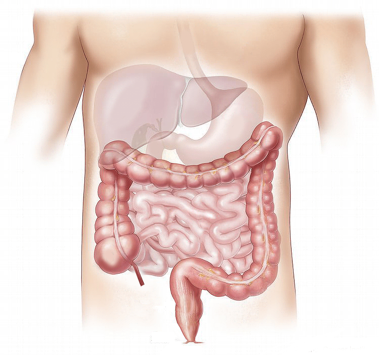 what is the root cause of SIBO