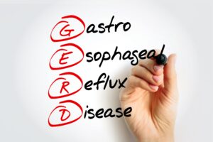 GERD-Naperville